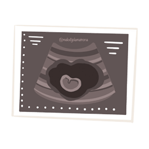 ecografias embarazo de las 12 semanas para calcular el tiempo de gestación
