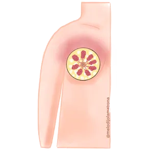 diagrama del pecho en una mastitis con lactancia