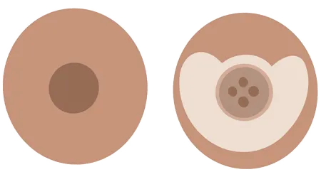 consulta matrona para resolver las dudas