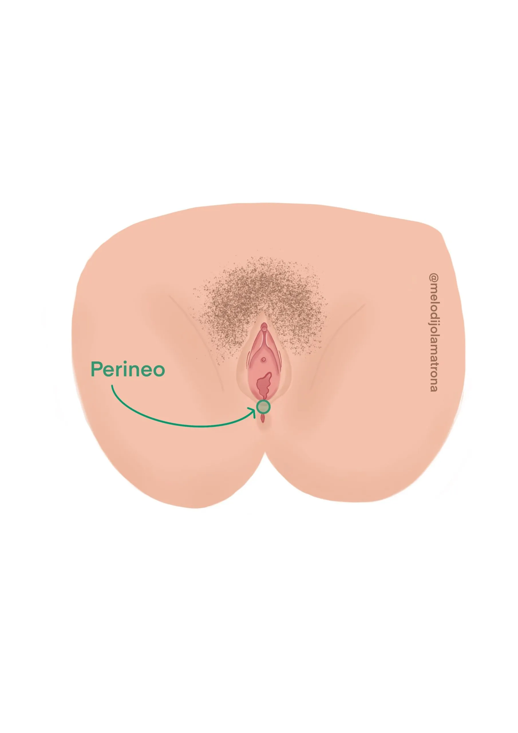 episiotomia definicion corte perineo
