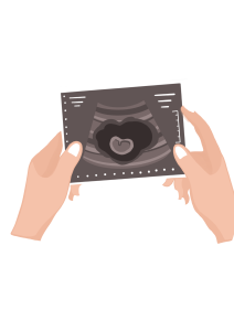 es normal no tener sintomas embarazo