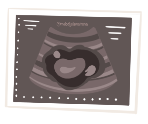cómo se detecta la endometriosis ecografía ginecológica