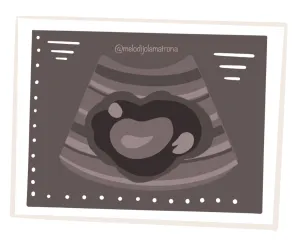 cómo se detecta la endometriosis ecografía ginecológica