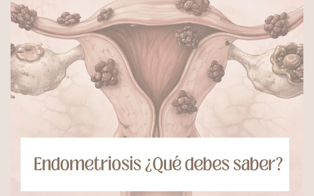 como se detecta la endometriosis imagen de portada que representa el aparato reproductor femenino marcado por lesiones de endometriosis