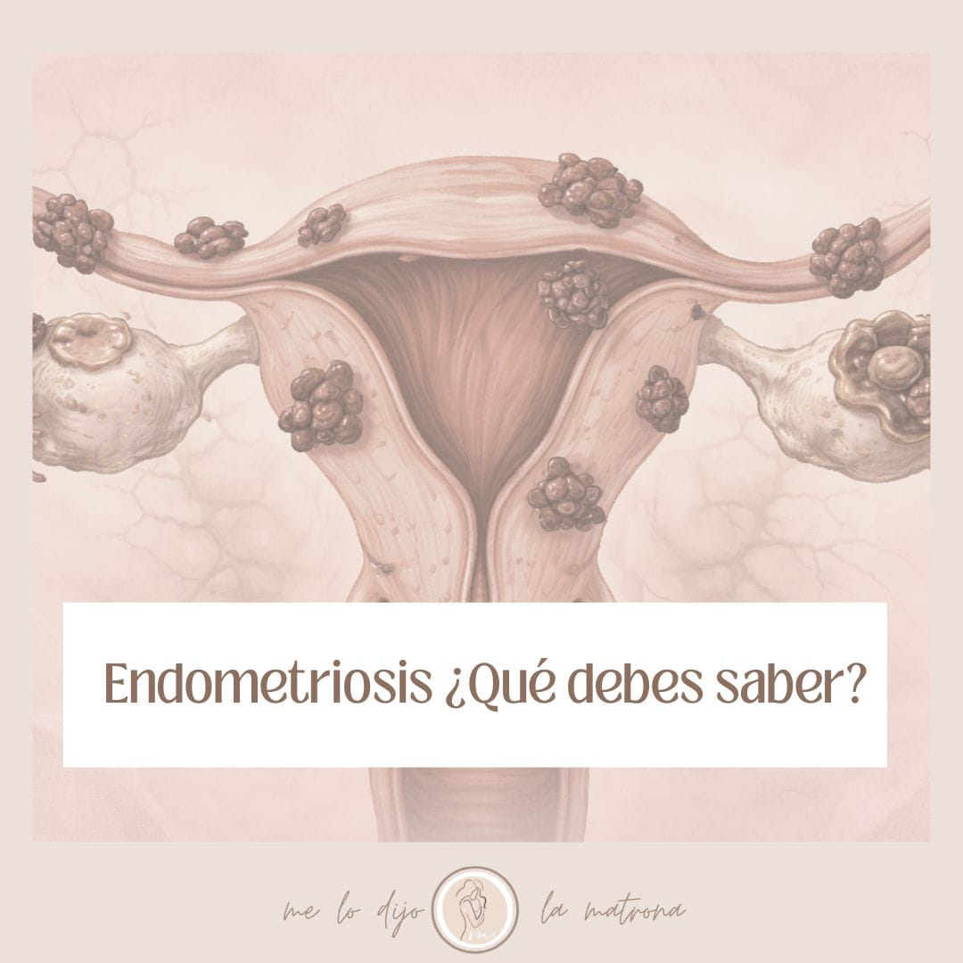 ¿Cómo se detecta la endometriosis?