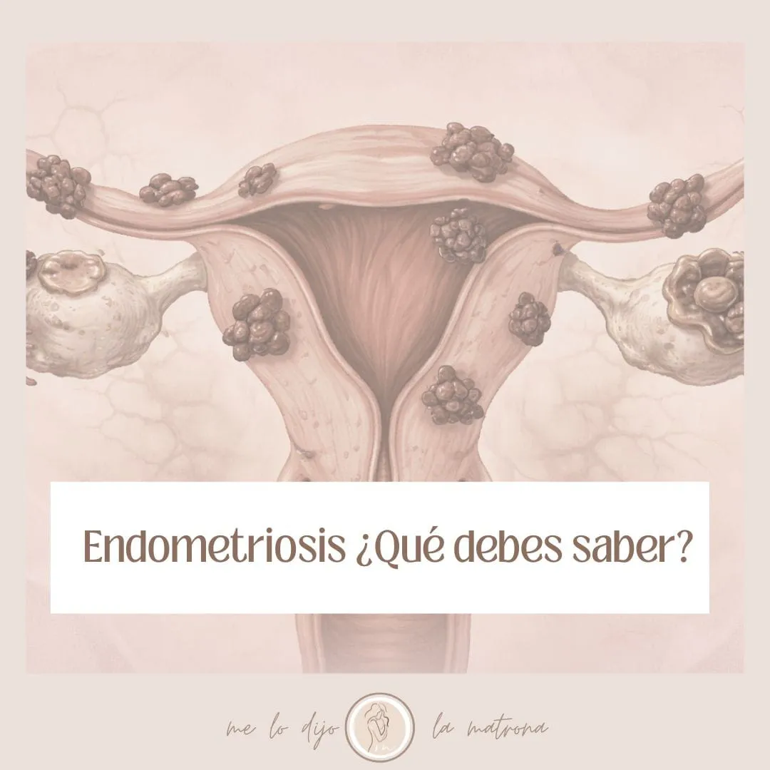 ¿Cómo se detecta la endometriosis?